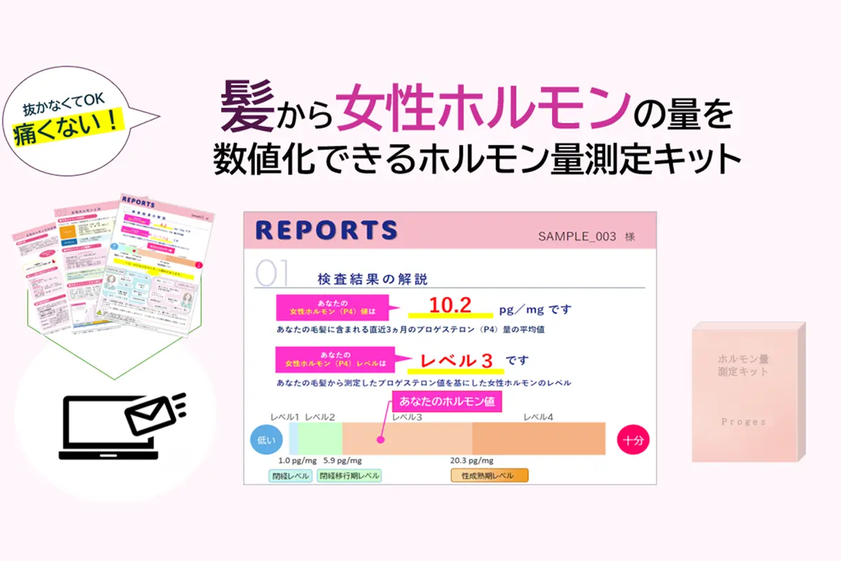 Proges（プロジェス）